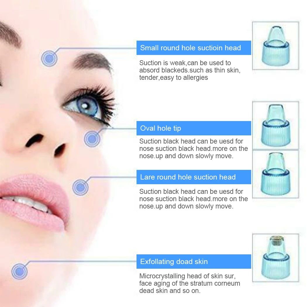 4-in-1 Cell Operated Blackhead Removal Machine Derma Suction