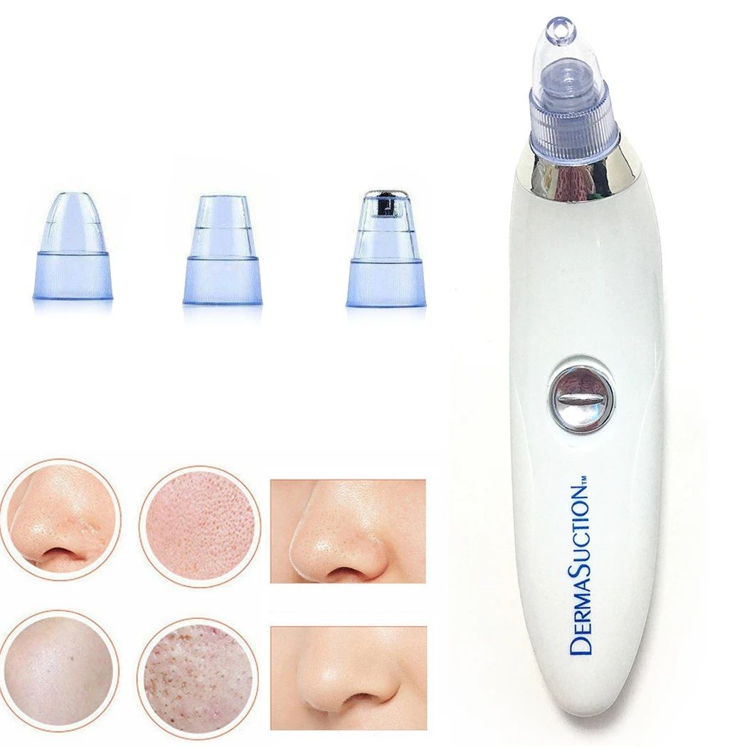 4-in-1 Cell Operated Blackhead Removal Machine Derma Suction